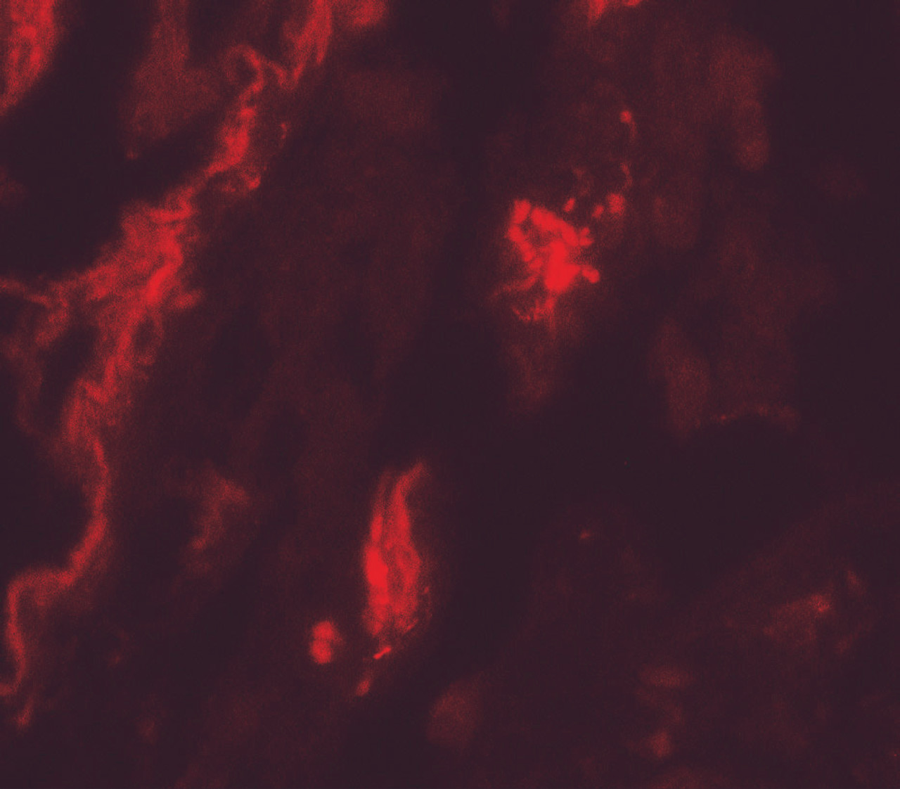 Immunofluorescence of TFEB in human lung tissue with TFEB antibody at 20 ug/mL.