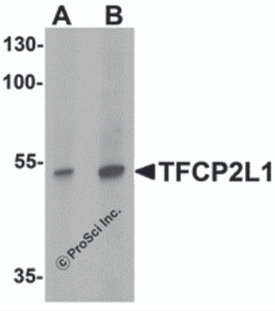 Western blot analysis of TFCP2L1 in human colon tissue lysate with TFCP2L1 antibody at (A) 1 and (B) 2 &#956;g/mL