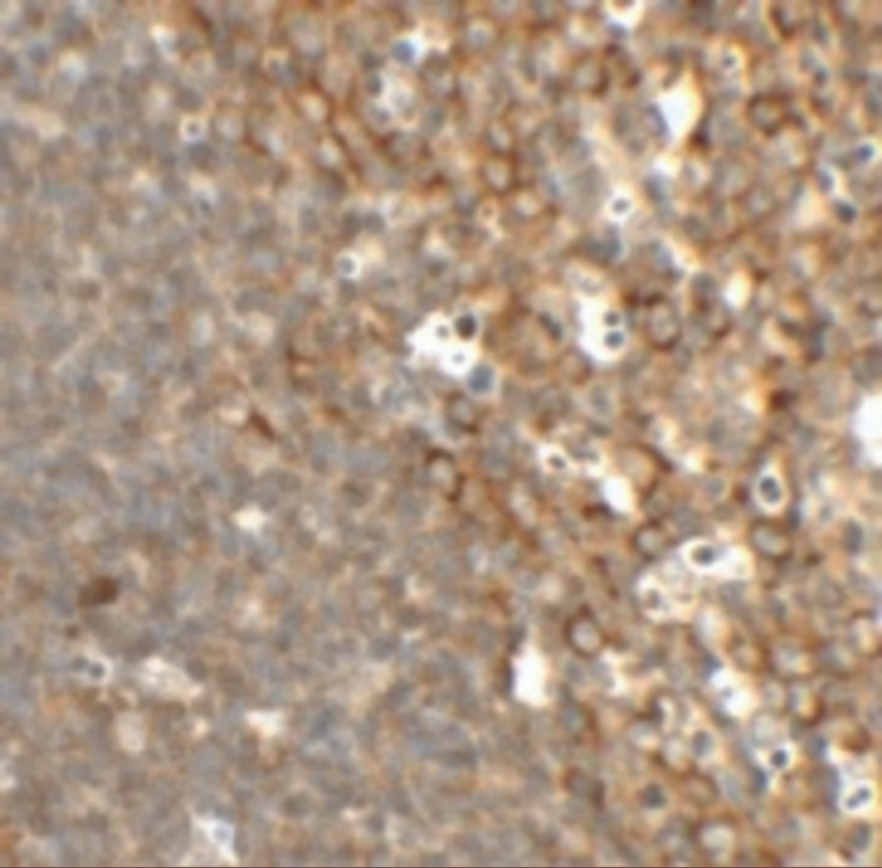 Immunohistochemistry of TFCP2L1 in rat colon tissue with TFCP2L1 antibody at 2.5 ug/mL.