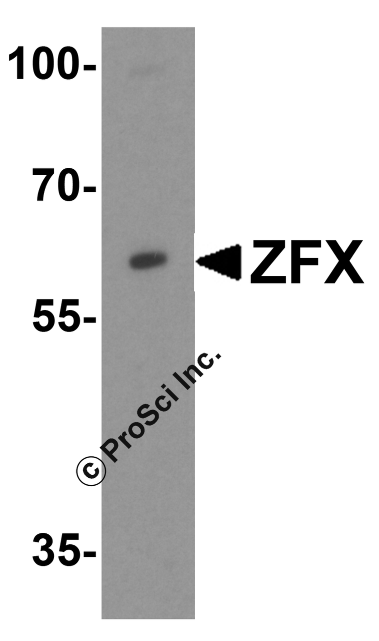 Western blot analysis of ZFX in Daudi cell lysate with ZFX antibody at 1 &#956;g/mL.