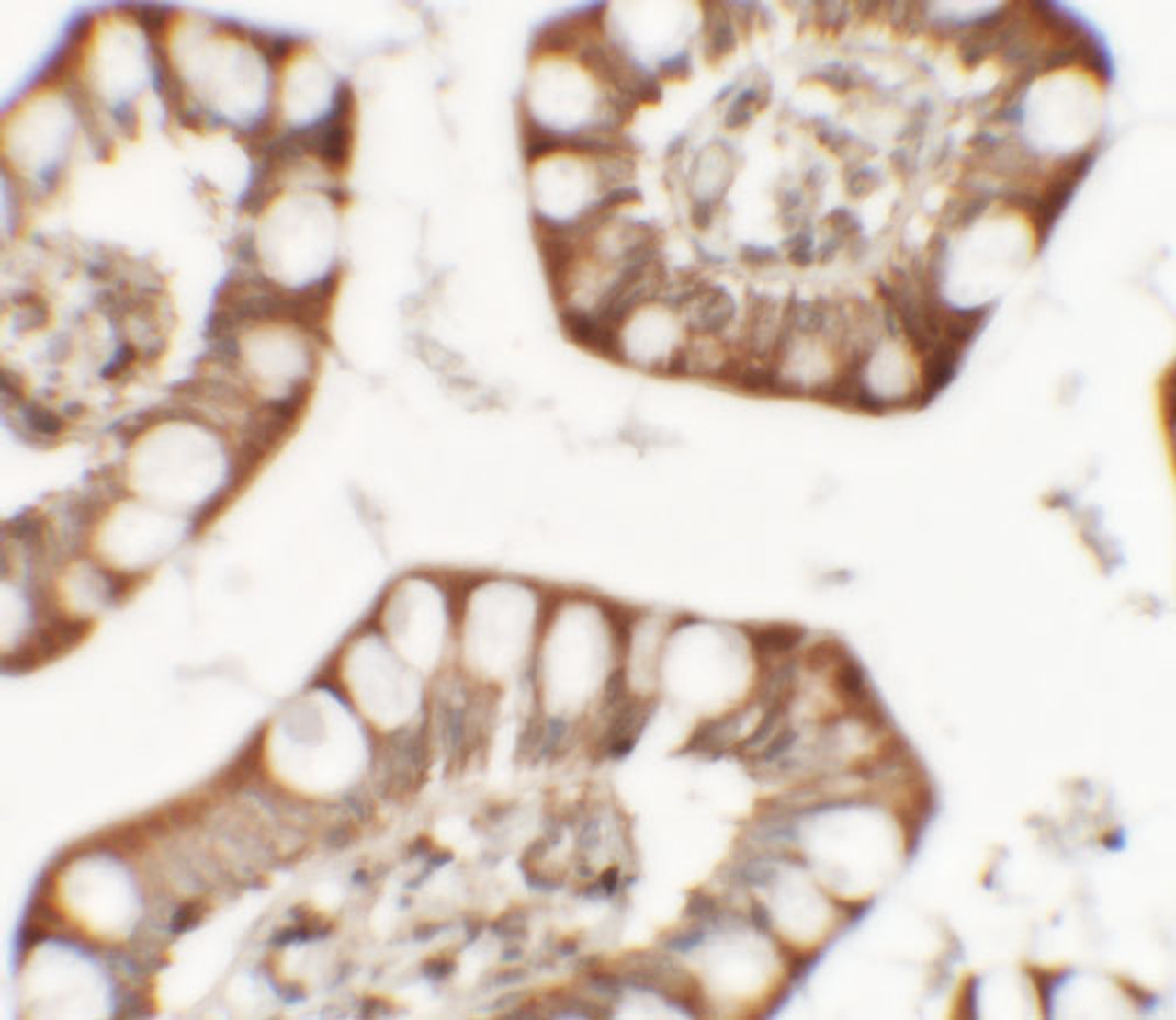 Immunohistochemistry of ZFX in human small intestine tissue with ZFX antibody at 5 ug/mL.