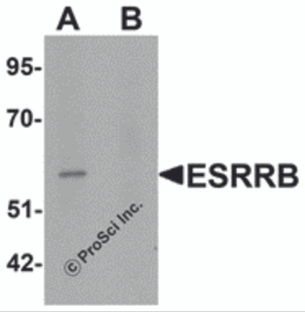 Western blot analysis of ESRRB in human heart tissue lysate with ESRRB antibody at 1 &#956;g/mL in (A) the absence and (B) the presence of blocking peptide.
