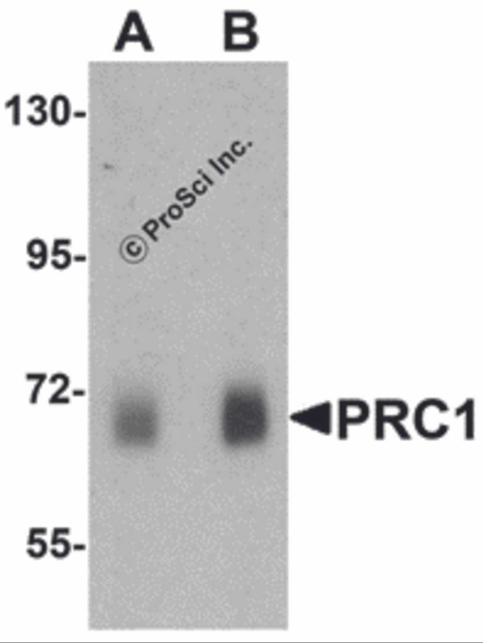 Western blot analysis of PRC1 in human skeletal muscle tissue lysate with Prc1 antibody at (A) 0.5 &#956;g/ml and (B) 1 &#956;g/mL.
