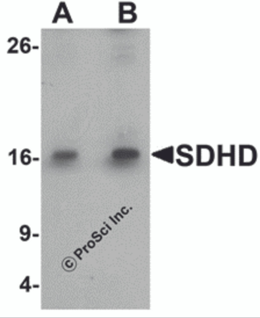 Western blot analysis of SDHD in EL4 cell lysate with SDHD antibody at (A) 1 and (B) 2 &#956;g/mL.