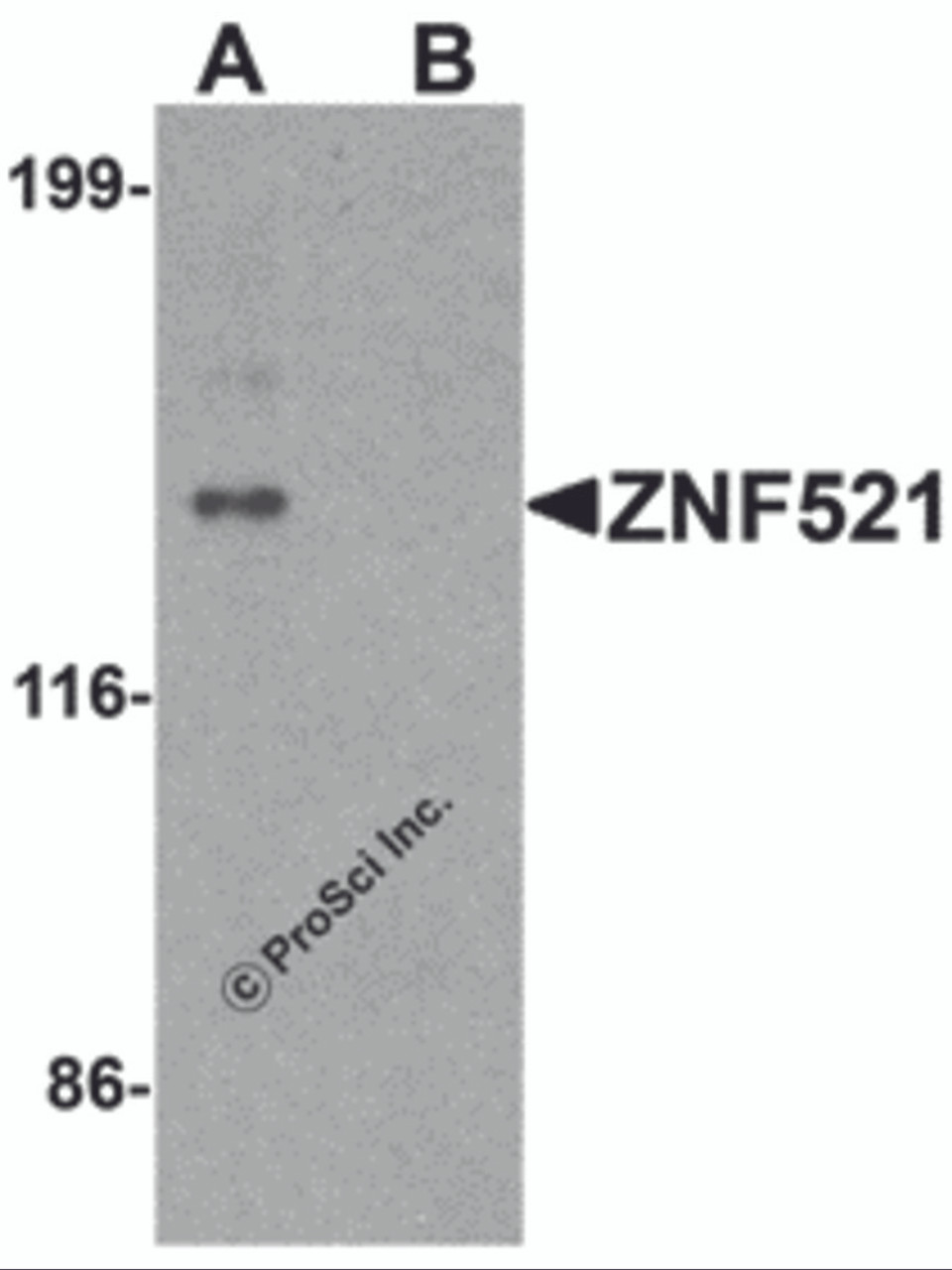 Western blot analysis of ZNF521 in HeLa cell lysate with ZNF521 antibody at 1 &#956;g/ml in (A) the absence and (B) the presence of blocking peptide.