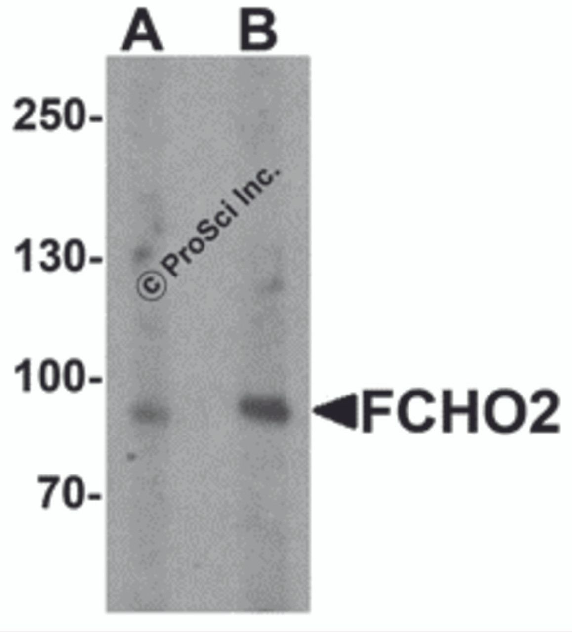Western blot analysis of FCHO2 in rat heart tissue lysate with FCHO2 antibody at (A) 1 and (B) 2 &#956;g/ml