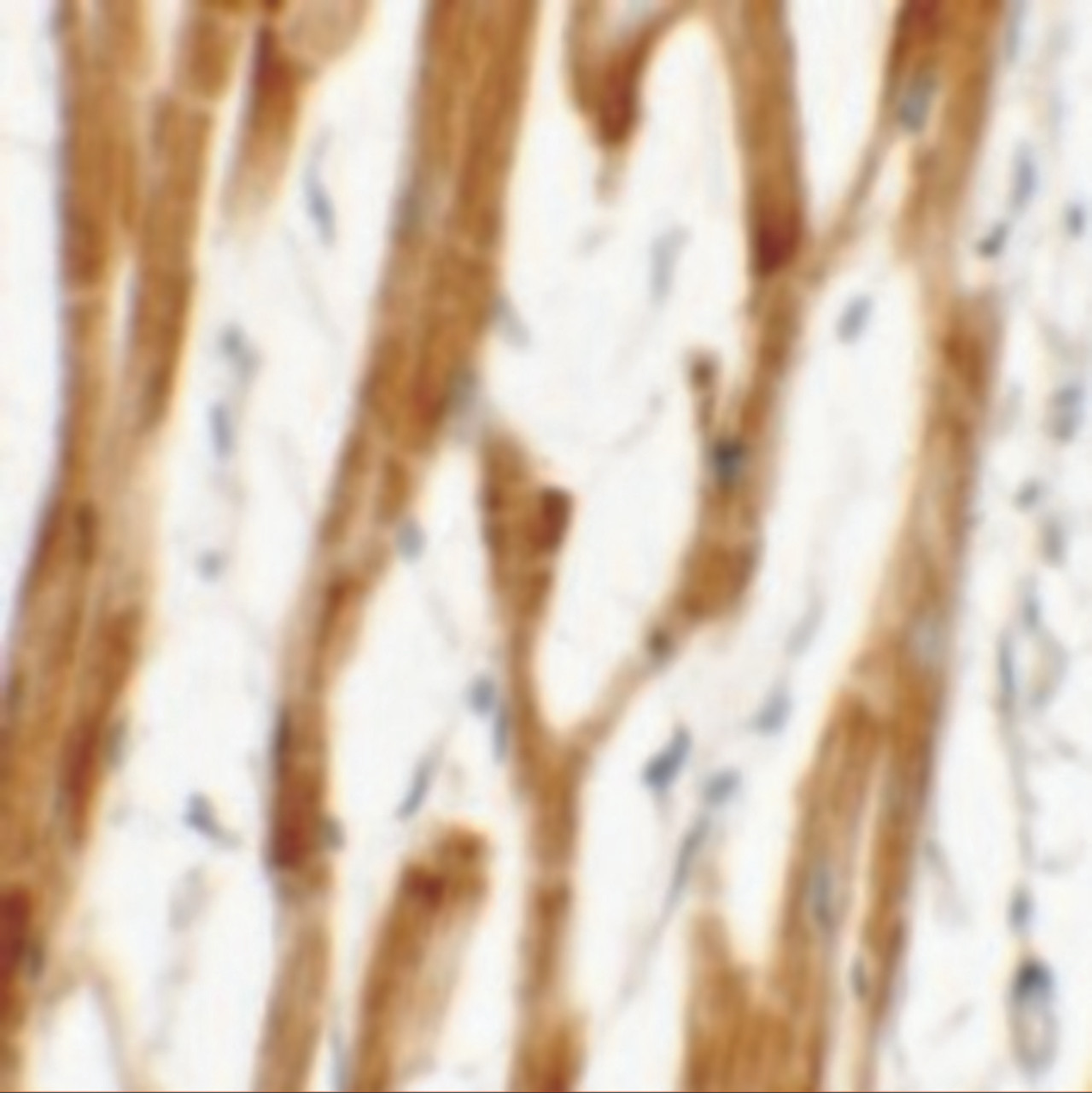 Immunohistochemistry of FCHO2 in human heart tissue with FCHO2 antibody at 2.5 ug/mL.