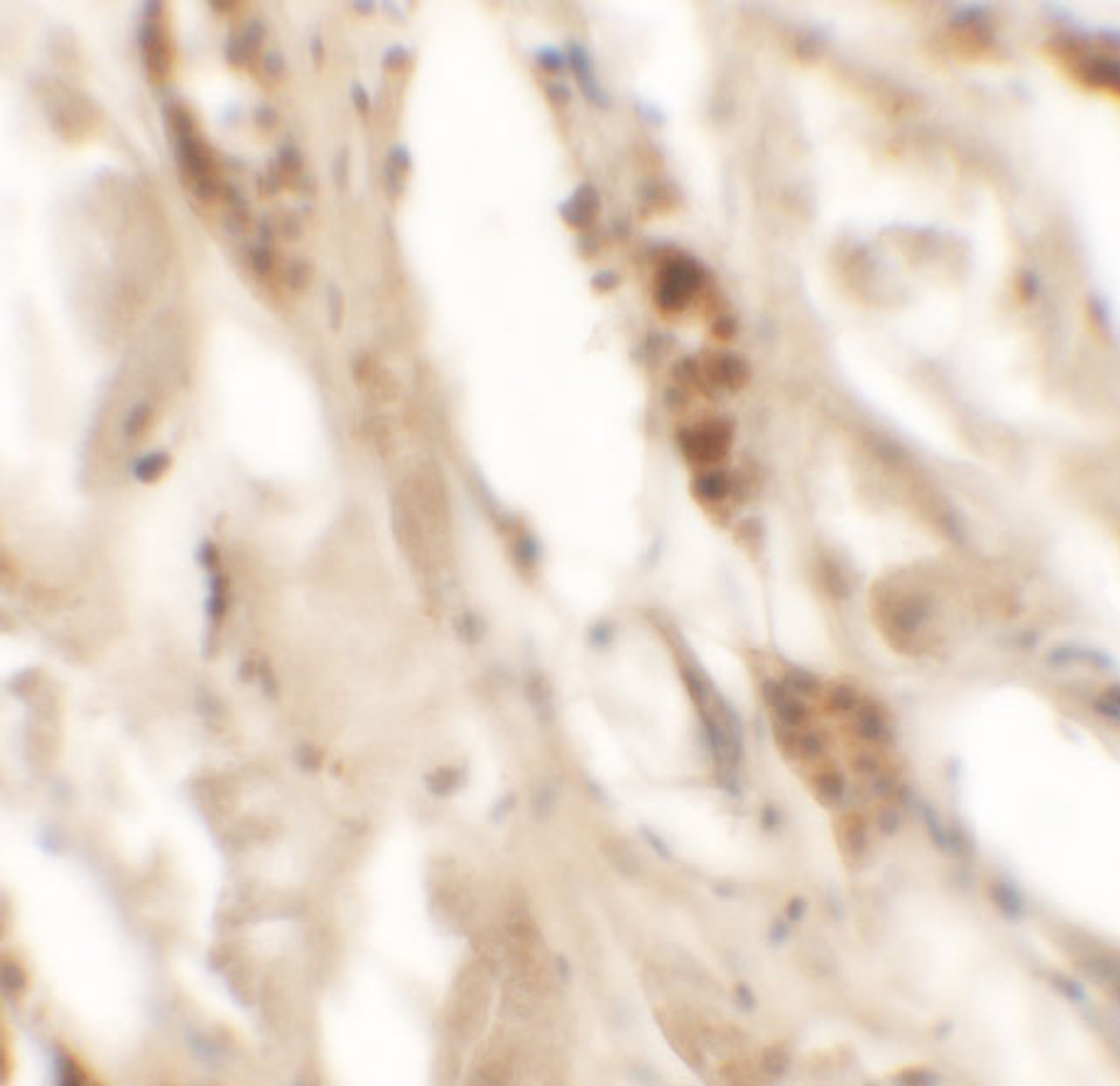 Immunohistochemistry of DBX2 in human kidney tissue with DBX2 antibody at 5 ug/mL.