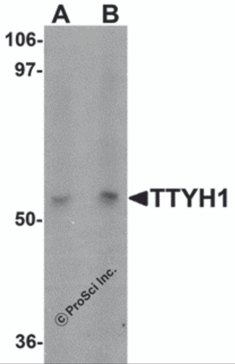 Western blot analysis of TTYH1 in Raji cell lysate with TTYH1 antibody at (A) 1 and (B) 2 &#956;g/mL.