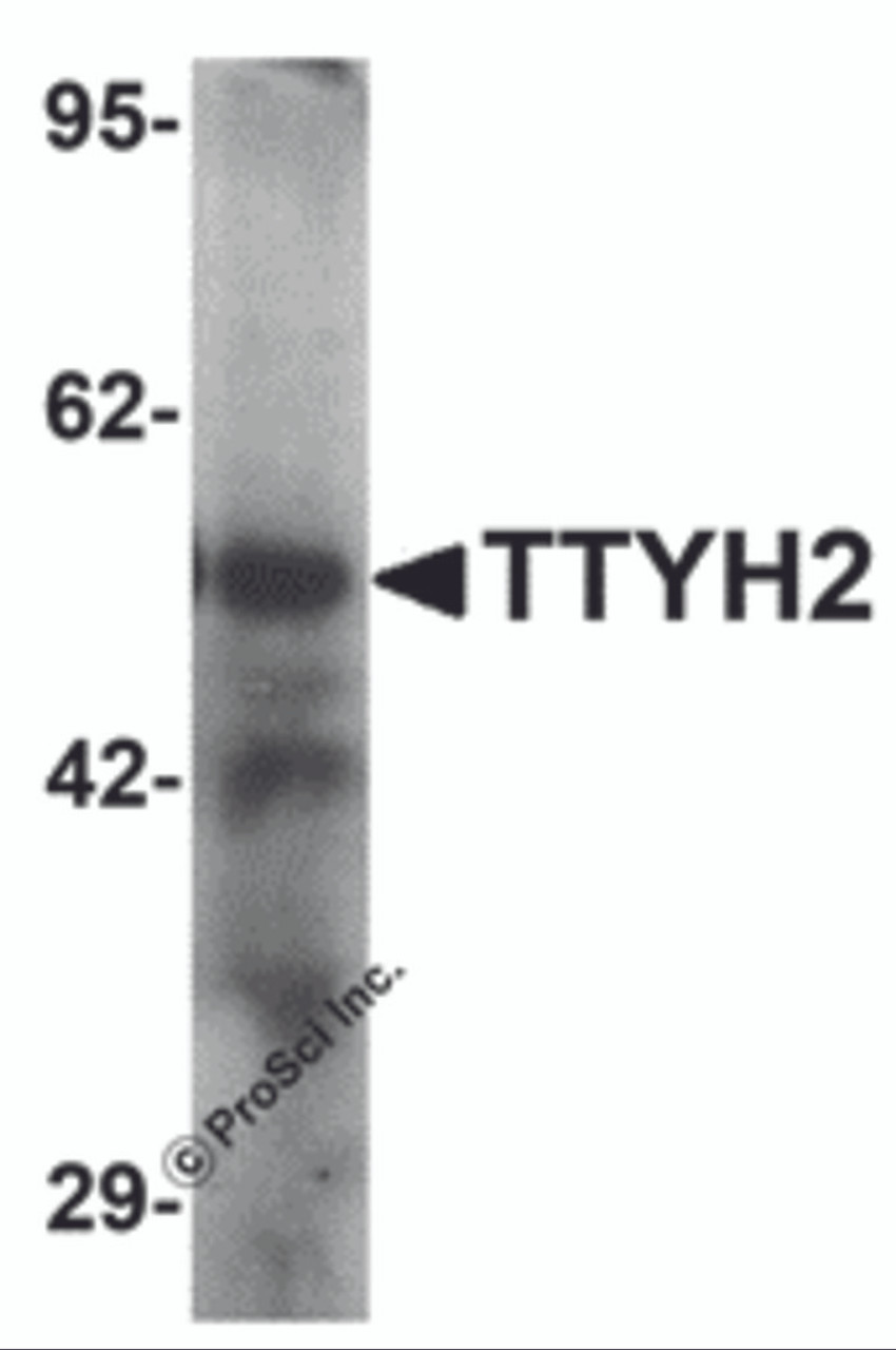 Western blot analysis of TTYH2 in human kidney tissue lysate with TTYH2 antibody at 1 &#956;g/ml