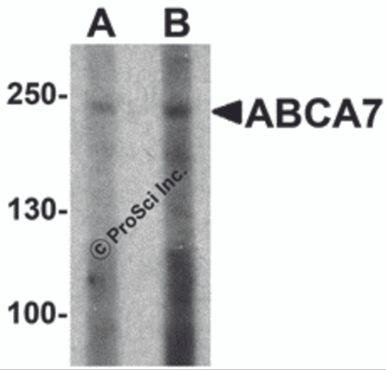 Western blot analysis of ABCA7 in 293 cell lysate with ABCA7 antibody at (A) 1 and (B) 2 &#956;g/mL.