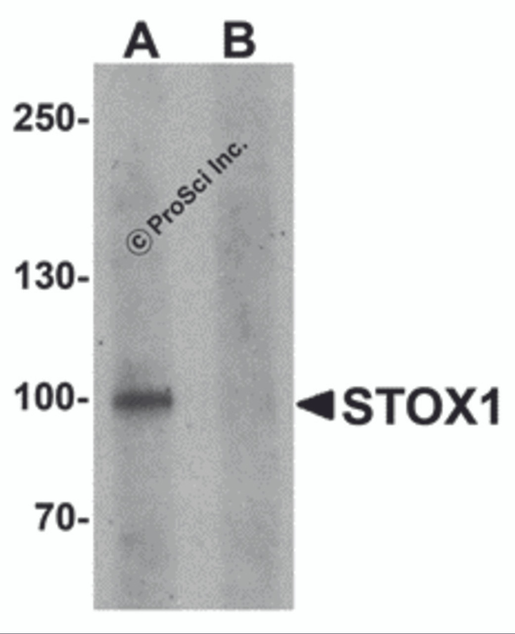 Western blot analysis of STOX1 in human liver tissue lysate with STOX1 antibody at 1 &#956;g/ml in (A) the absence and (B) the presence of blocking peptide.