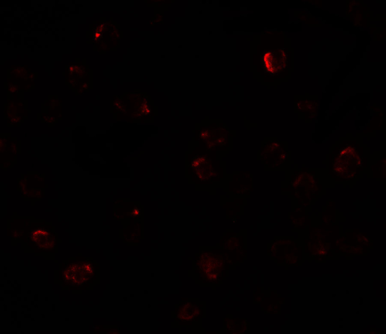 Immunofluorescence of ZBTB40 in Raji cells with ZBTB40 antibody at 20 ug/mL.