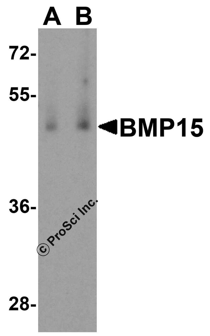 Western blot analysis of BMP15 in human testis tissue lysate with BMP15 antibody at (A) 1 and (B) 2 &#956;g/mL.