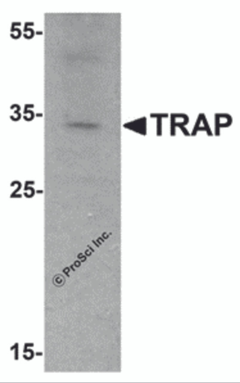 Western blot analysis of TRAP in mouse brain tissue lysate with TRAP antibody at 1 &#956;g/mL.