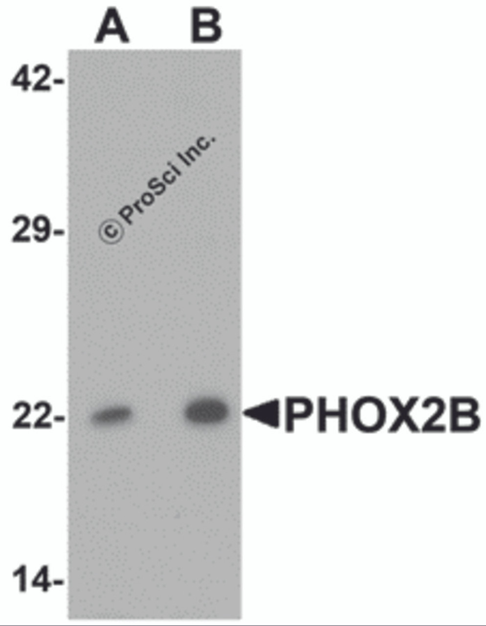 Western blot analysis of PHOX2B in 293 cell lysate with PHOX2B antibody at (A) 1 and (B) 2 &#956;g/mL.