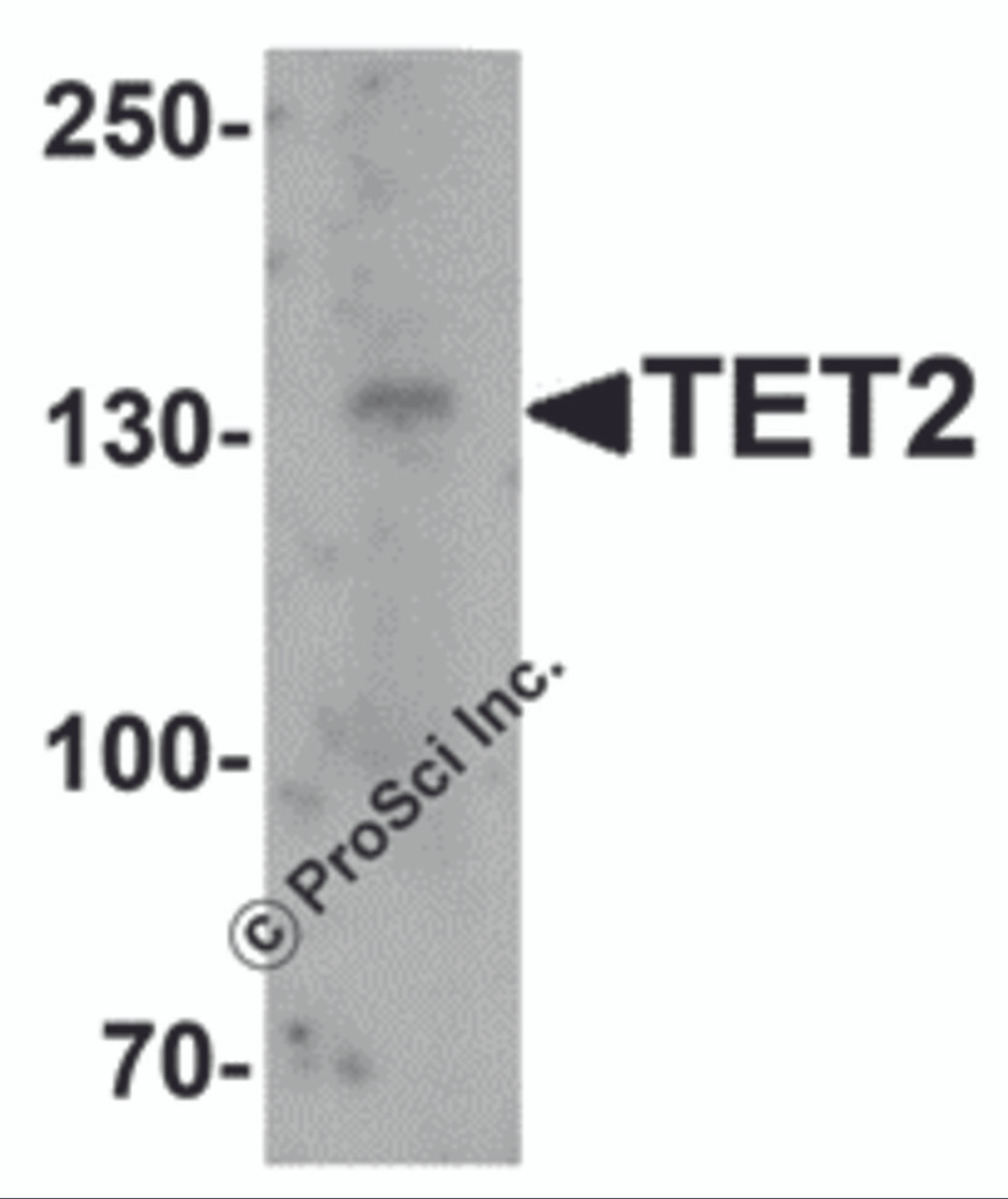 Western blot analysis of TET2 in SK-N-SH cell lysate with TET2 antibody at 1 &#956;g/mL.