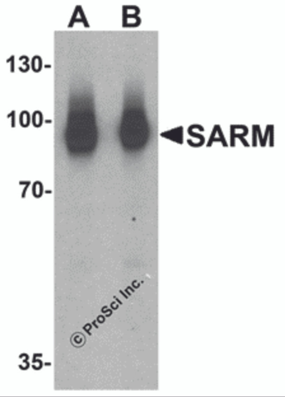 Western blot analysis of SARM in Daudi cell lysate with SARM antibody at (A) 1 and (B) 2 &#956;g/mL.