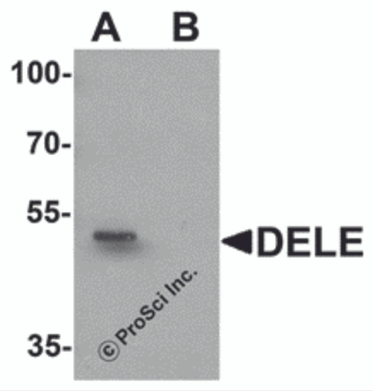 Western blot analysis of DELE in rat brain tissue lysate with DELE antibody at 1 &#956;g/ml in (A) the absence and (B) the presence of blocking peptide.