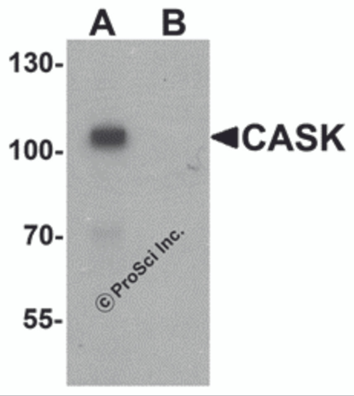 Western blot analysis of CASK in mouse brain tissue lysate with CASK antibody at 1 &#956;g/ml in (A) the absence and (B) the presence of blocking peptide.