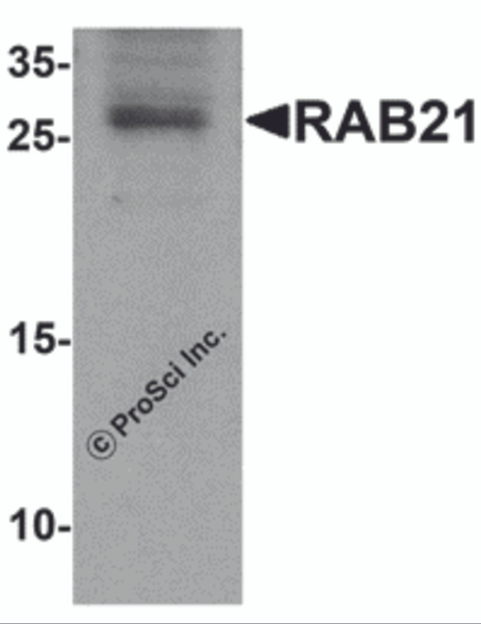 Western blot analysis of RAB21 in mouse kidney tissue lysate with RAB21 antibody at 1 &#956;g/mL.