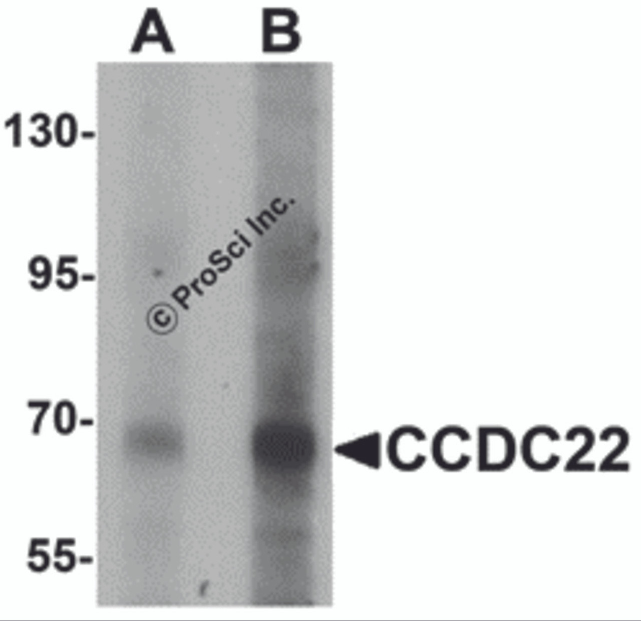 Western blot analysis of CCDC22 in 293 cell lysate with CCDC22 antibody at (A) 1 and (B) 2 &#956;g/mL.