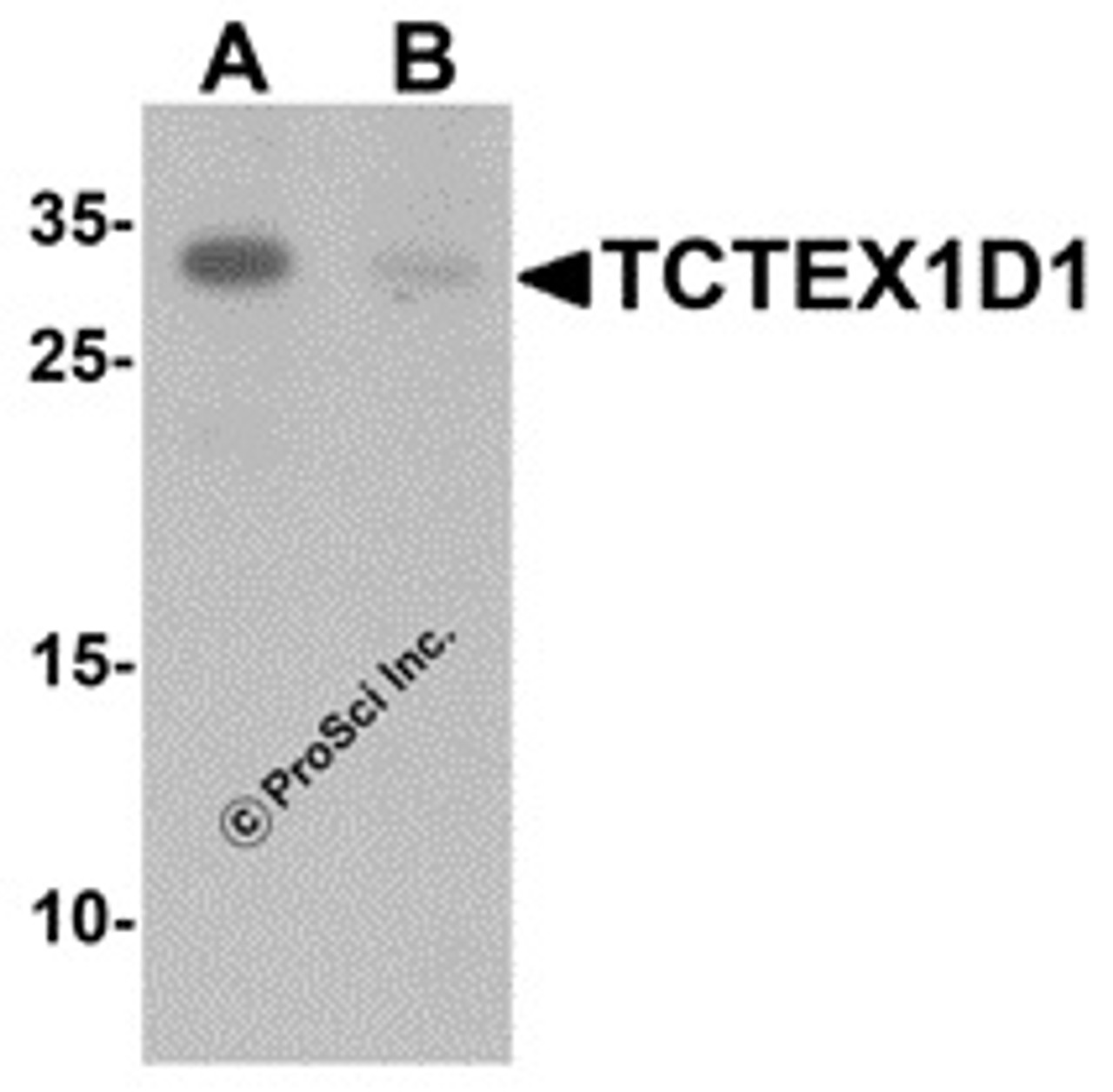 Western blot analysis of TCTEX1D1 in K562 cell lysate with TCTEX1D1 antibody at 1 &#956;g/mL in (A) the absence and (B) the presence of blocking peptide.