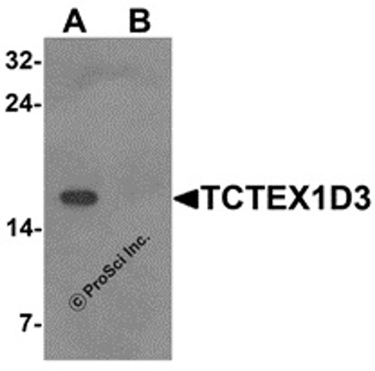 Western blot analysis of TCTEX1D3 in EL4 cell lysate with TCTEX1D3 antibody at 1 &#956;g/mL in (A) the absence and (B) the presence of blocking peptide.