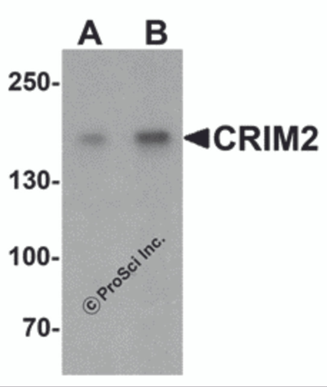 Western blot analysis of CRIM2 in Jurkat cell lysate with CRIM2 antibody at (A) 1 and (B) 2 &#956;g/mL.