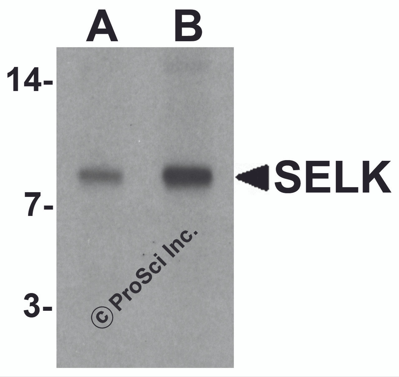 Western blot analysis of SELK in A20 cell lysate with SELK antibody at (A) 1 and (B) 2 &#956;g/mL.