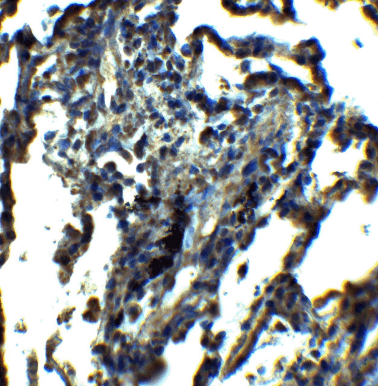 Immunohistochemistry of NDFIP1 in human lung tissue with NDFIP1 antibody at 5 ug/ml.