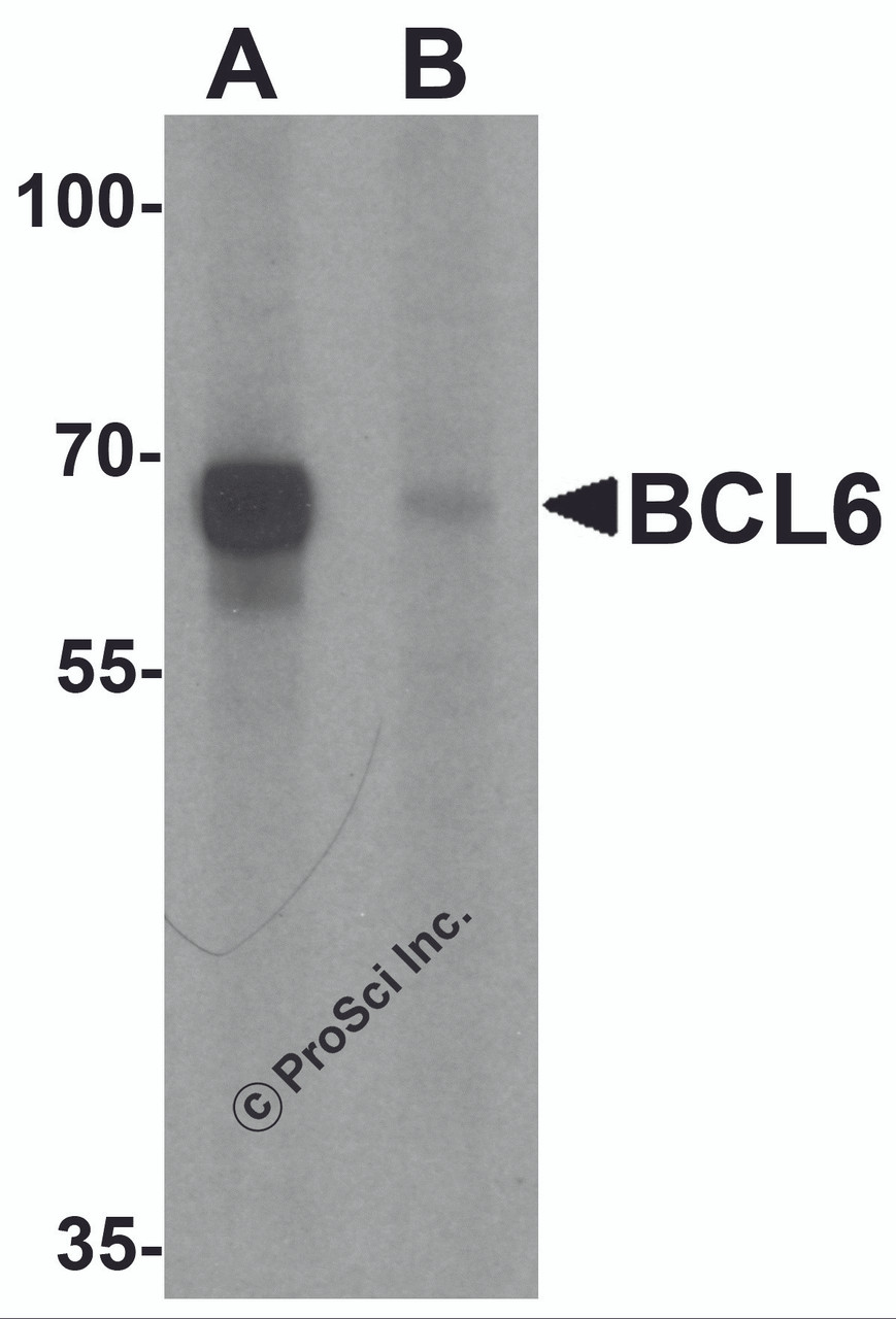 Western blot analysis of BCL6 in rat lung tissue lysate with Bcl6 antibody at 1 &#956;g/ml in (A) the absence and (B) the presence of blocking peptide