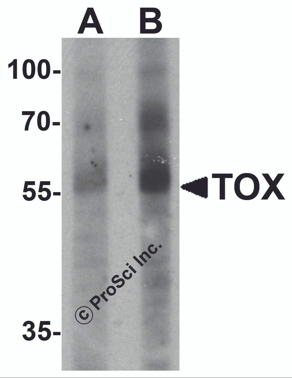 Western blot analysis of TOX in human colon tissue lysate with TOX antibody at (A) 1 and (B) 2 &#956;g/mL.