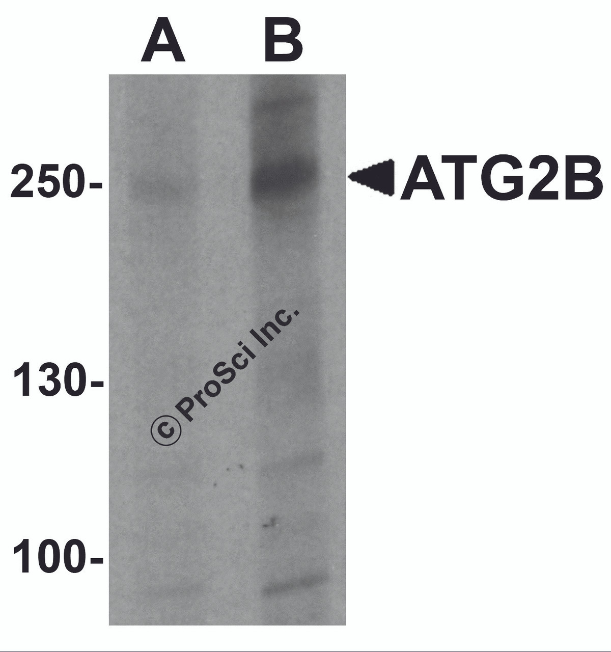 Western blot analysis of ATG2B in K562 cell lysate with ATG2B antibody at (A) 1 and (B) 2 &#956;g/ml