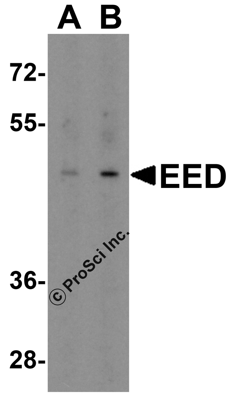 Western blot analysis of EED in human heart tissue lysate with EED antibody at (A) 1 and (B) 2 &#956;g/mL.