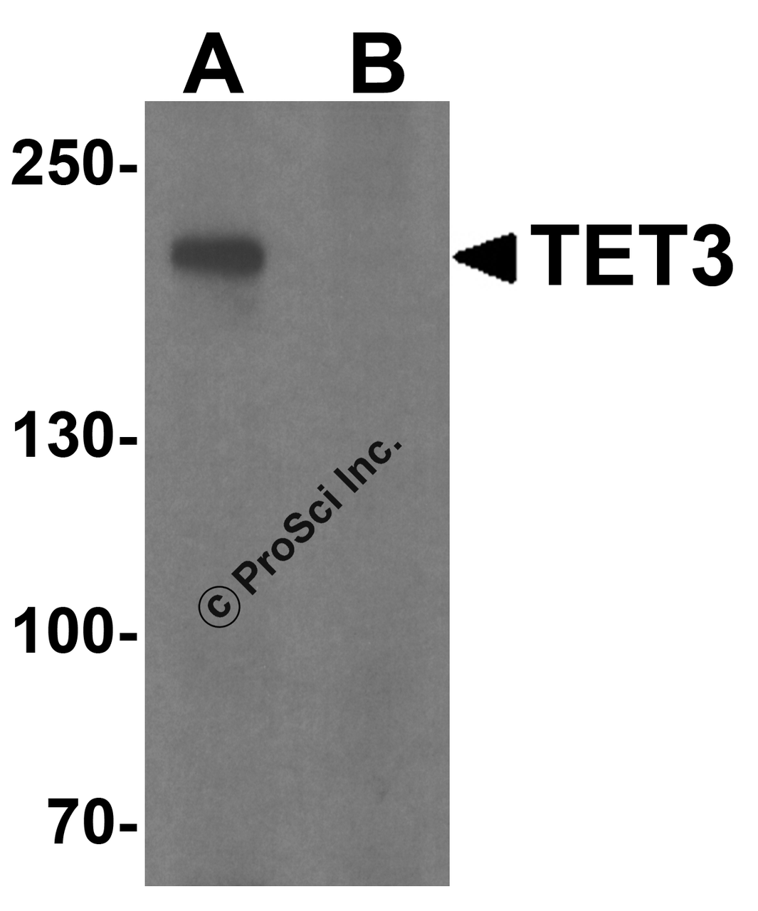 Western blot analysis of TET3 in SK-N-SH cell lysate with TET3 antibody at 1 &#956;g/ml in (A) the absence and (B) the presence of blocking peptide.