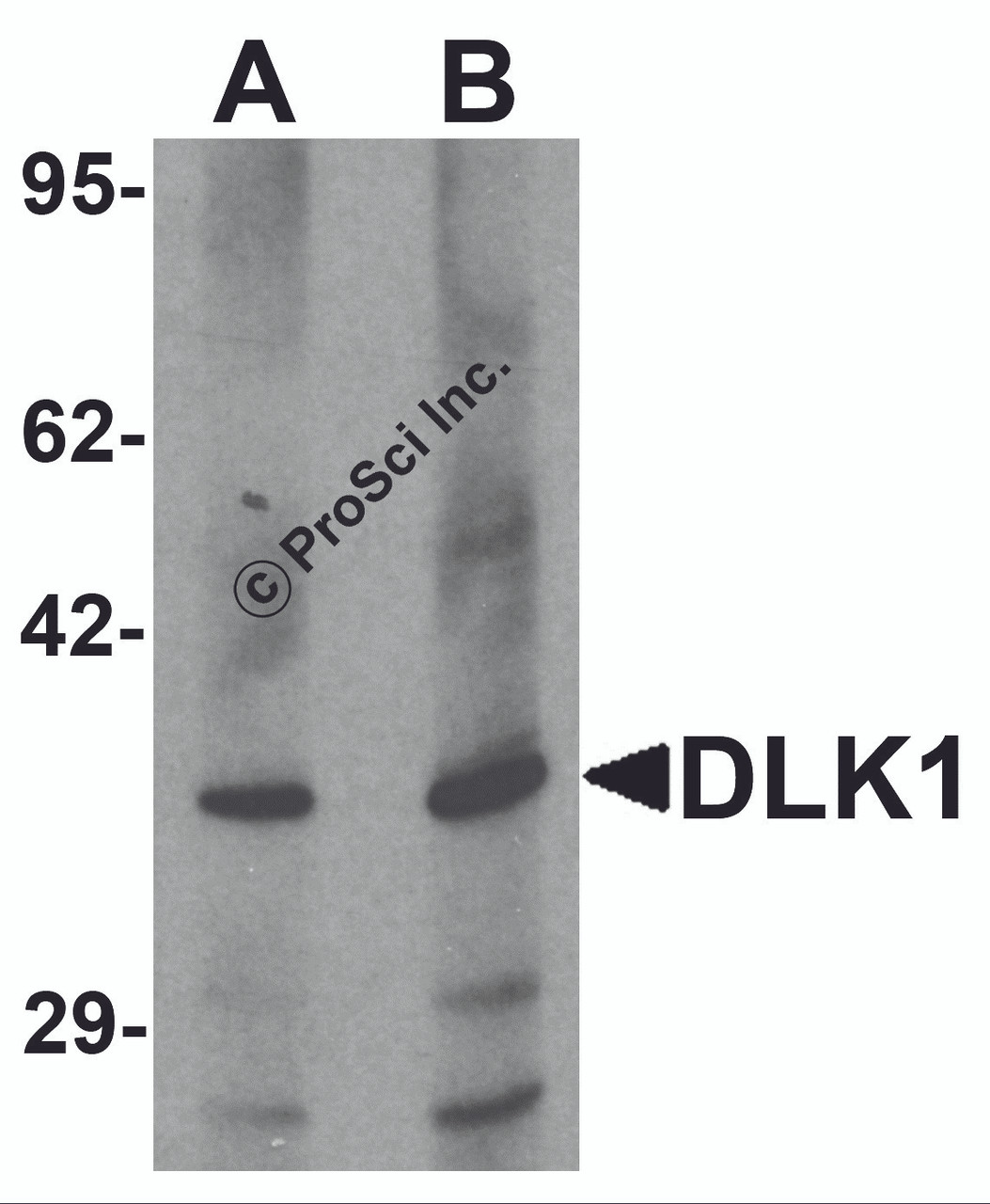Western blot analysis of HepG2 in 293 cell lysate with DLK1 antibody at (A) 1 and (B) 2 &#956;g/mL.
