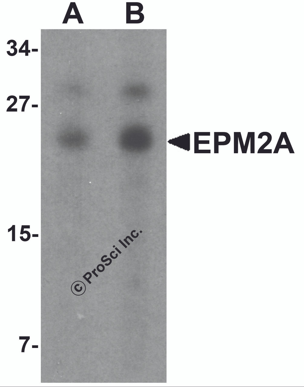 Western blot analysis of SW480 in SW480 cell lysate with EPM2A antibody at (A) 1 and (B) 2 &#956;g/mL.