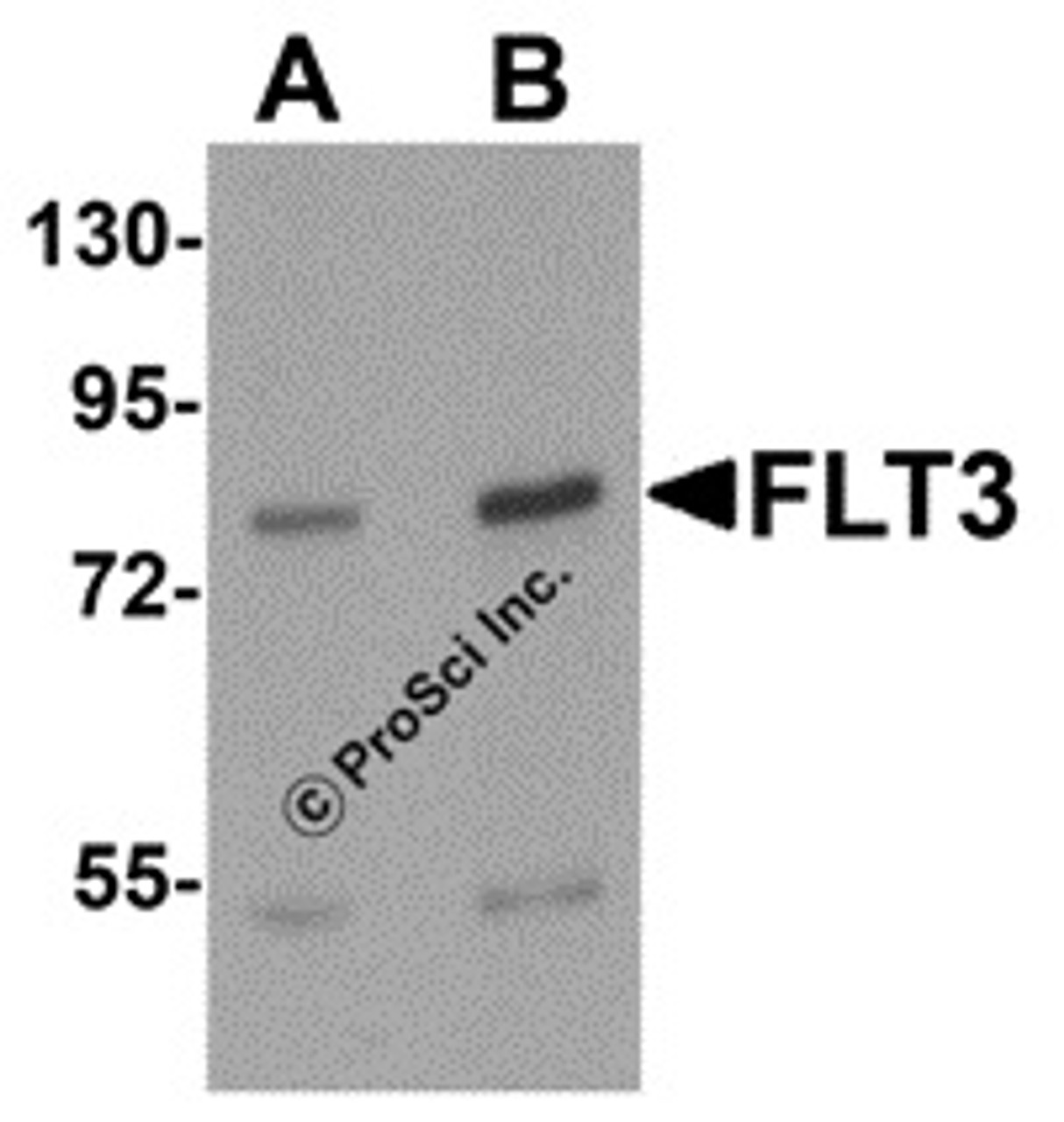 Western blot analysis of FLT3 in 3T3 cell lysate with FLT3 antibody at (A) 1 and (B) 2 &#956;g/mL.