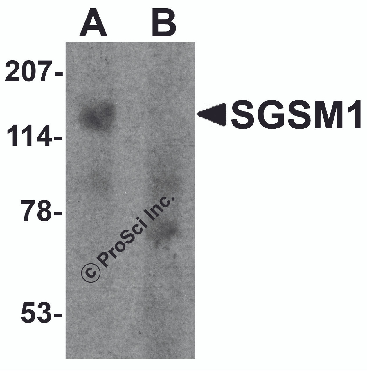 Western blot analysis of SGSM1 in human cerebellum tissue lysate with SGSM1 antibody at 1 &#956;g/ml in (A) the absence and (B) the presence of blocking peptide.