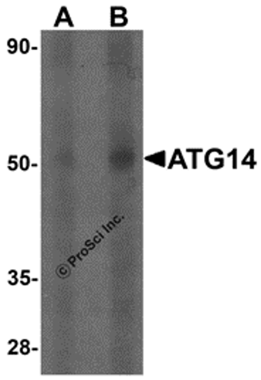 Western blot analysis of ATG14 in human small intestine tissue lysate with ATG14 antibody at (A) 1 and (B) 2 &#956;g/mL.