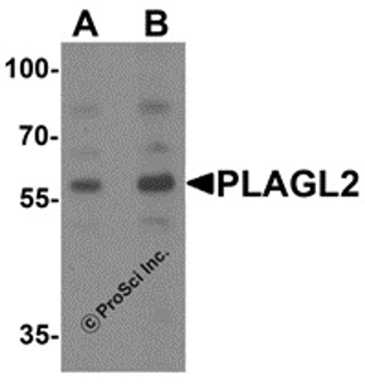 Western blot analysis of PLAGL2 in rat brain tissue lysate with PLAGL2 antibody at (A) 1 and (B) 2 &#956;g/mL.