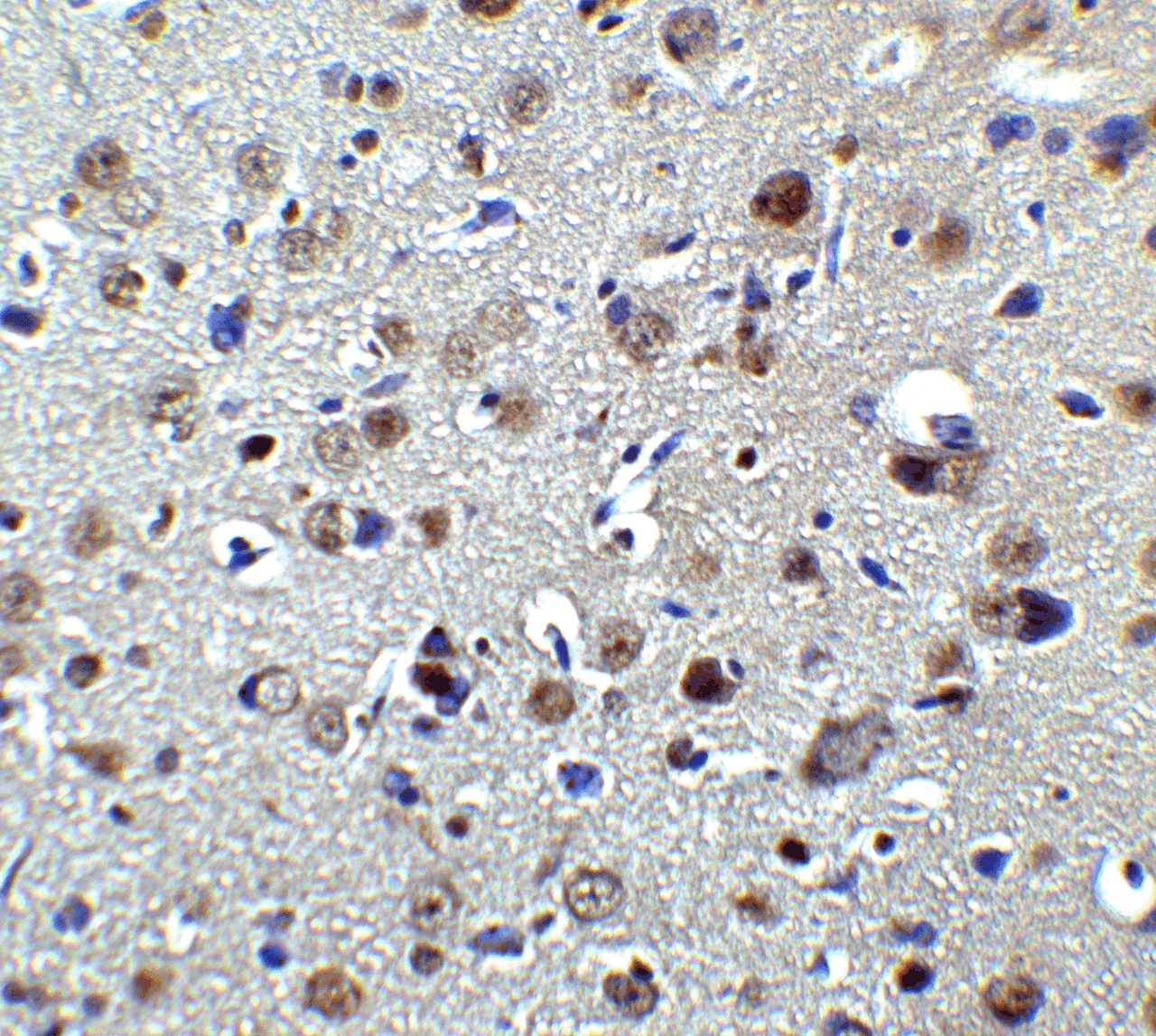 Immunohistochemistry of PLAGL2 in rat brain tissue with PLAGL2 antibody at 2 ug/ml.