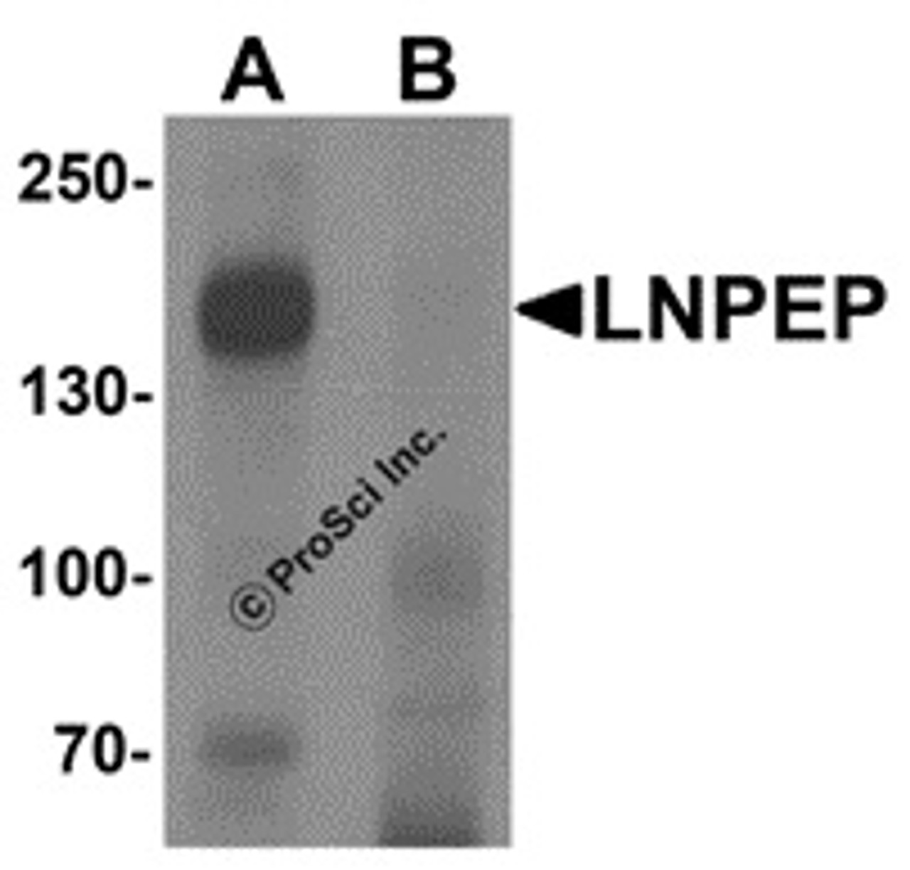 Western blot analysis of LNPEP in human lung tissue lysate with LNPEP antibody at 1 &#956;g/mL in (A) the absence and (B) the presence of blocking peptide.