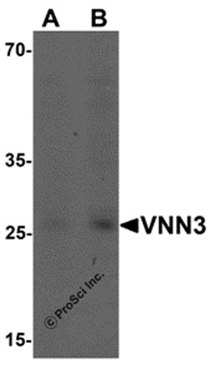 Western blot analysis of VNN3 in human brain tissue lysate with VNN3 antibody at (A) 0.5 and (B) 1 &#956;g/mL.