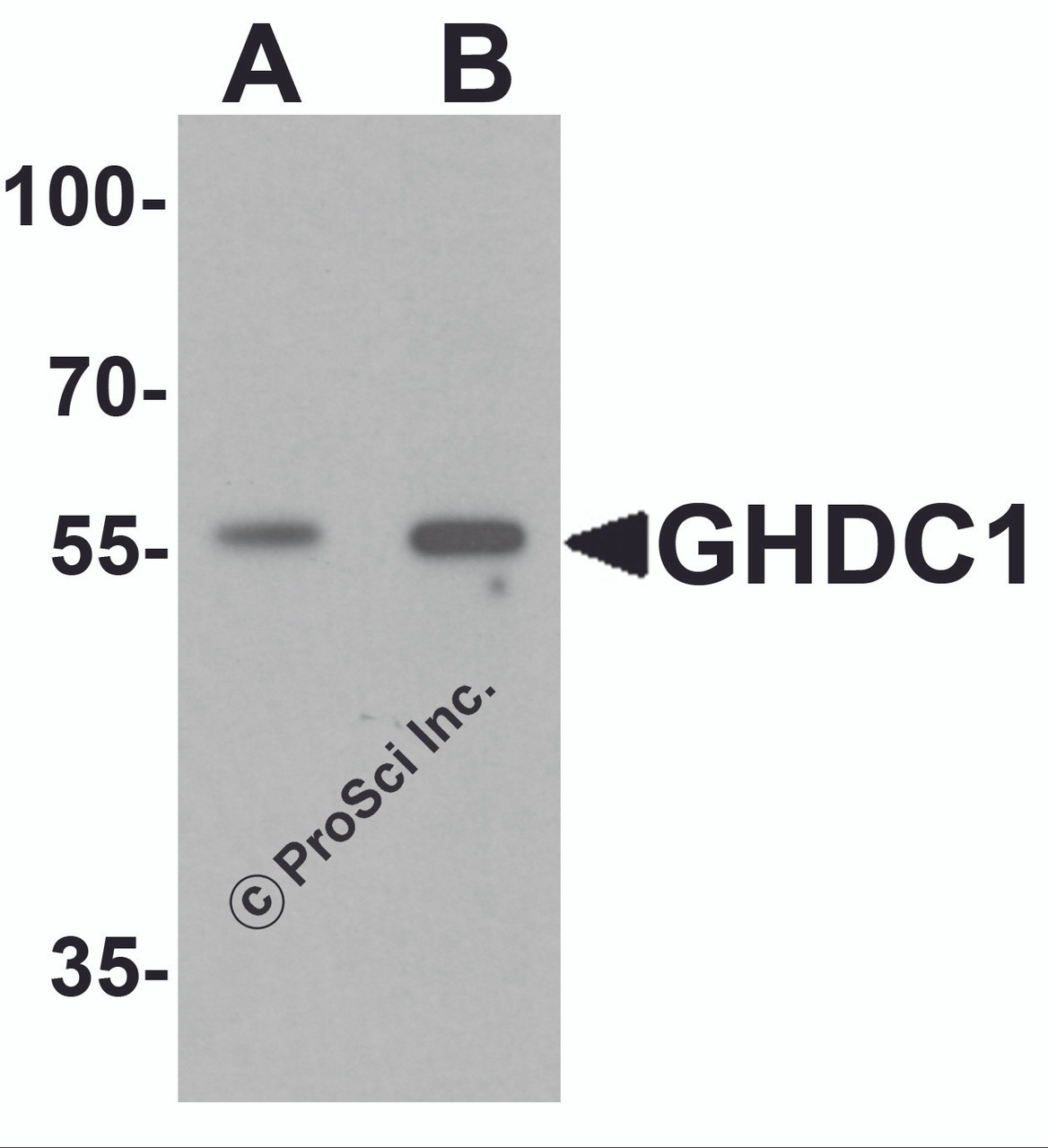 Western blot analysis of GHDC in 293 cell lysate with GHDC antibody at (A) 0.5 and (B) 1 &#956;g/mL.