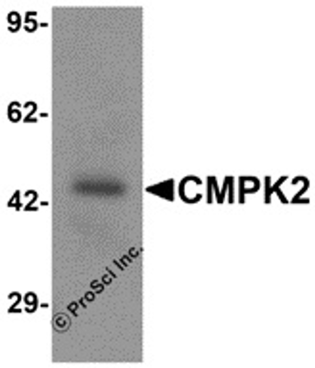Western blot analysis of CMPK2 in rat lung tissue lysate with CMPK2 antibody at 1 &#956;g/mL