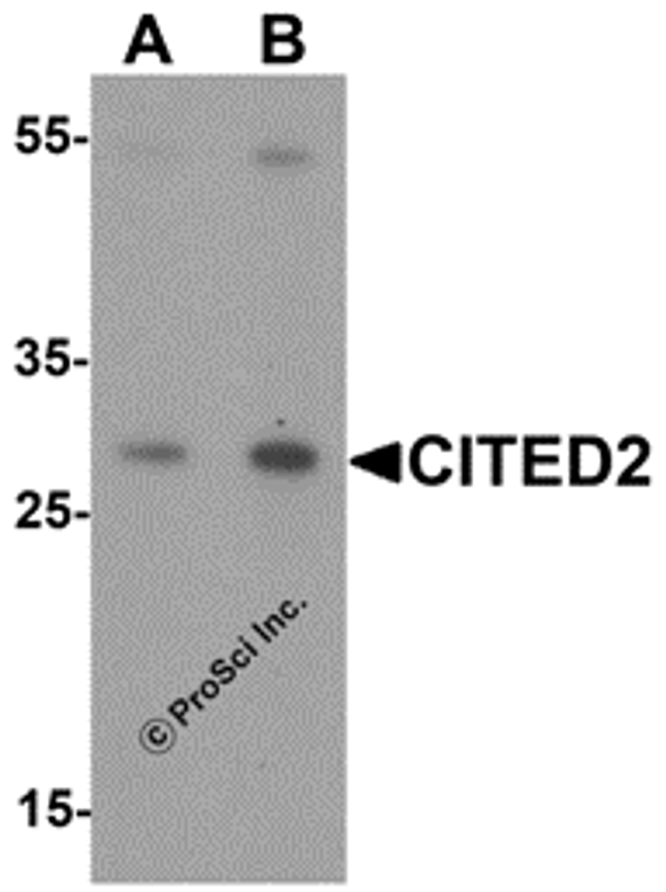 Western blot analysis of CITED2 in Jurkat cell lysate with CITED2 antibody at (A) 1 and (B) 2 &#956;g/mL.
