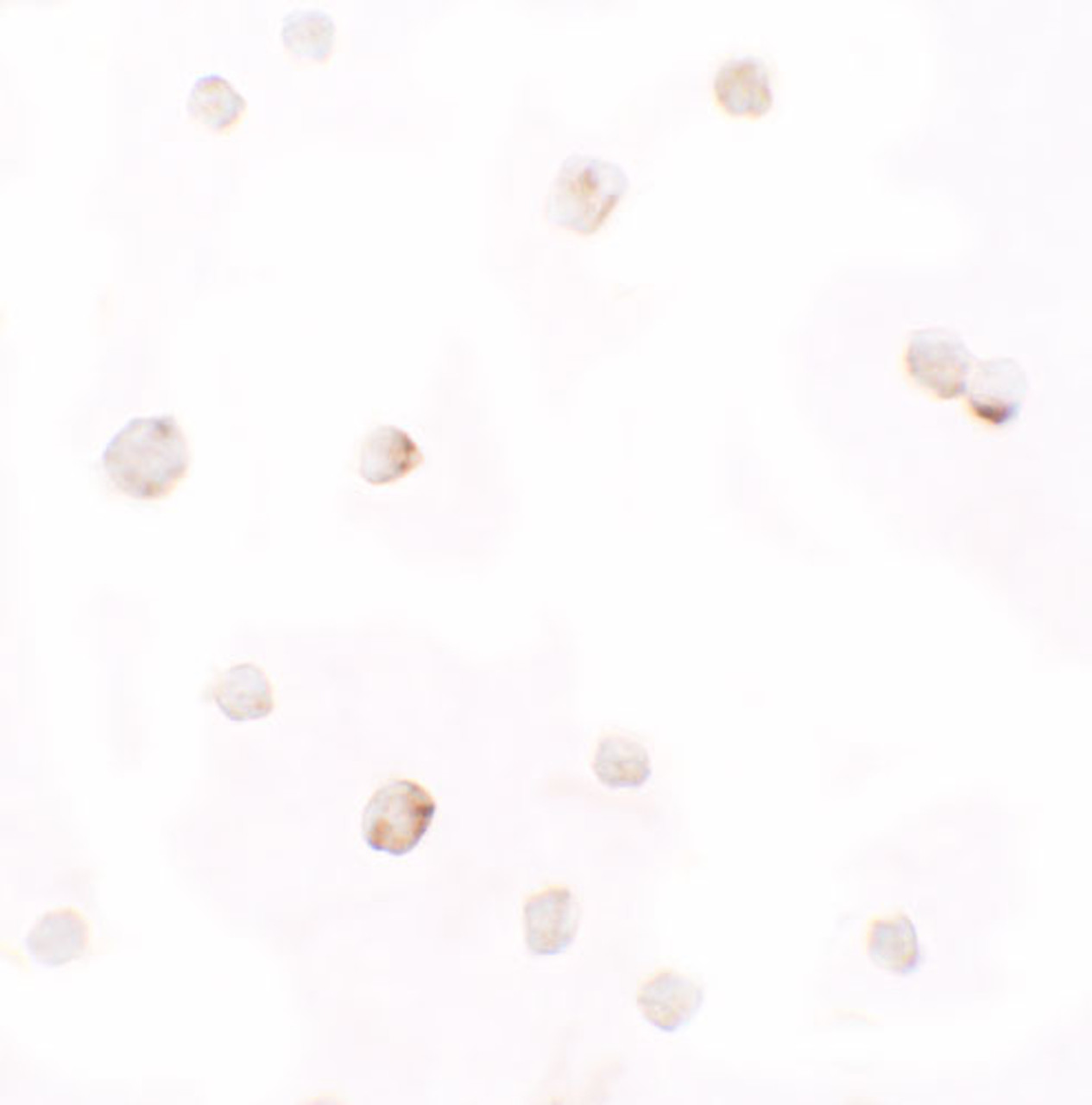 Immunocytochemistry of Pellino in HepG2 cells with Pellino 1 antibody at 2.5 ug/ml.