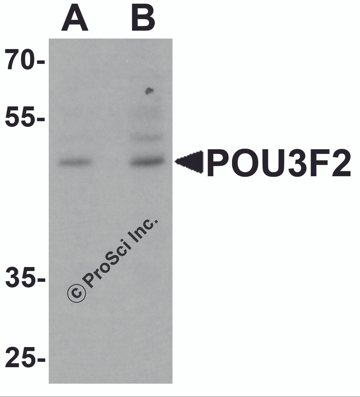Western blot analysis of POU3F2 in 3T3 cell lysate with POU3F2 antibody at (A) 1 and (B) 2 &#956;g/mL.